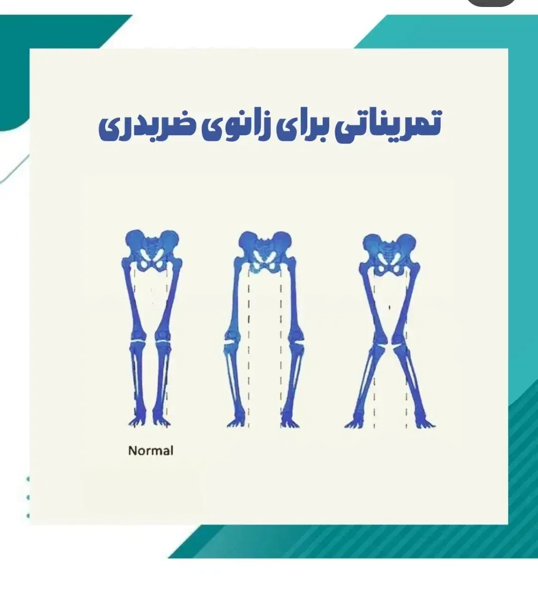 حرکات اصلاحی|خدمات آموزشی|ارومیه, |دیوار