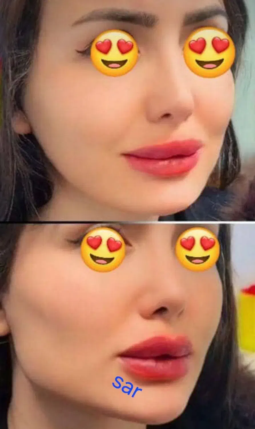 تزریق وآموزش ژل وبوتاکس  ۲۵۰۰ درکلینیک|خدمات آرایشگری و زیبایی|اهواز, بیست متری شهدا|دیوار