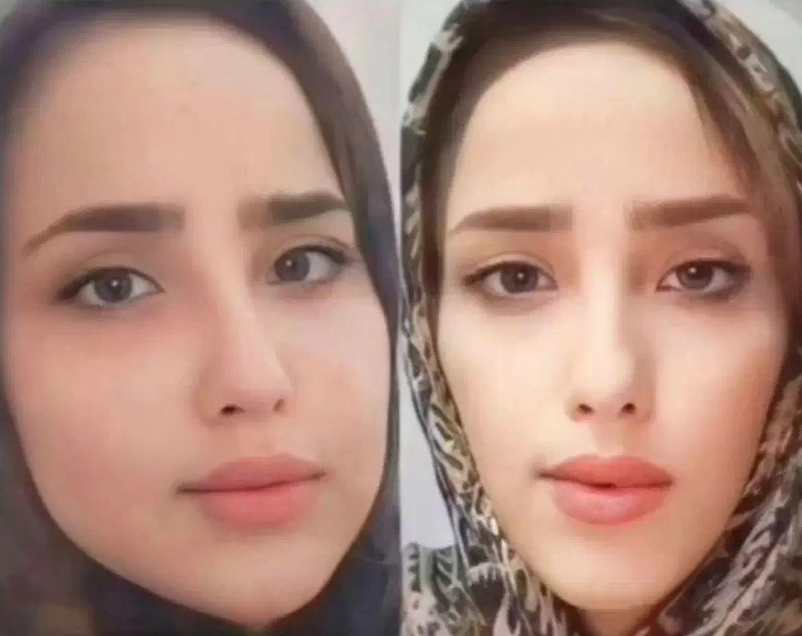 پری صورت|آرایشی، بهداشتی، درمانی|اهواز, امانیه|دیوار