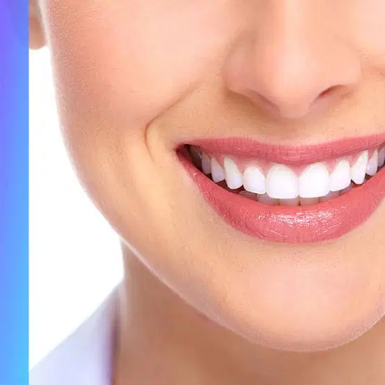 تخفیف محدود و ویژه خدمات دندانپزشکی|خدمات زیبایی و سلامت|تهران, صاحب الزمان|دیوار
