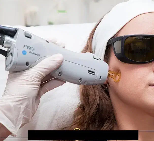 لیزر موهای زائد غیرتماسی کندلا|خدمات آرایشگری و زیبایی|دوگنبدان, |دیوار