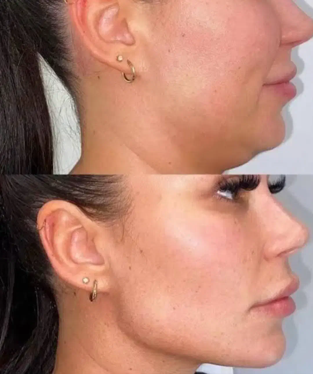 جشنواره ی پاییزه ژل ،بوتاکس،مزو|خدمات آرایشگری و زیبایی|شاهین‌شهر, فردوسی|دیوار