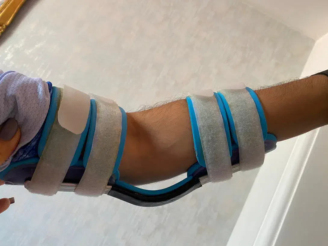 بازوبند طبی|آرایشی، بهداشتی، درمانی|لاهیجان, گلستان|دیوار