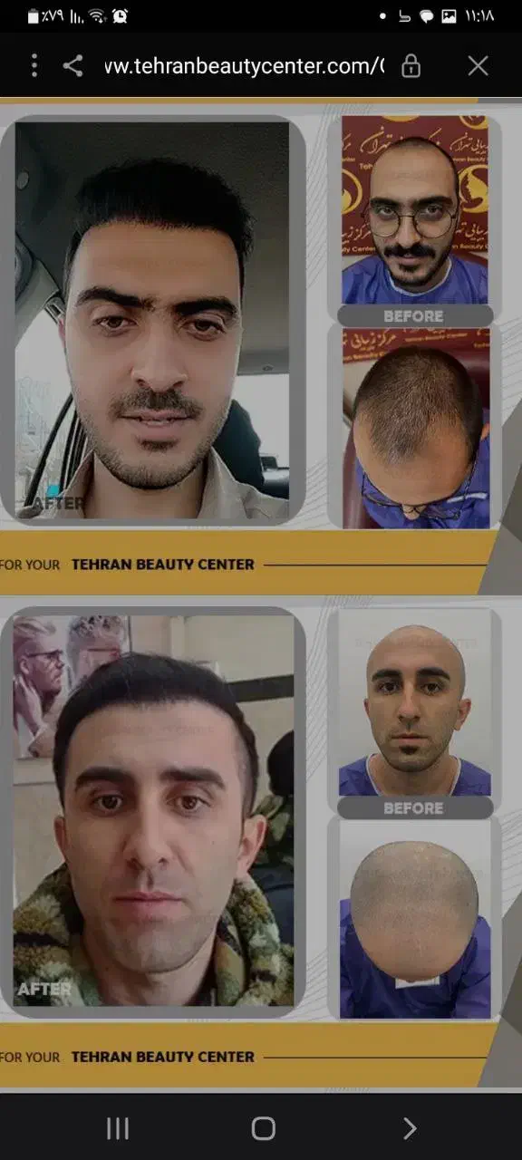 زیبایی/کاشت مو/رفع غبغب/تزریق ژل/ کلینیک در تهران|خدمات آرایشگری و زیبایی|ارومیه, |دیوار