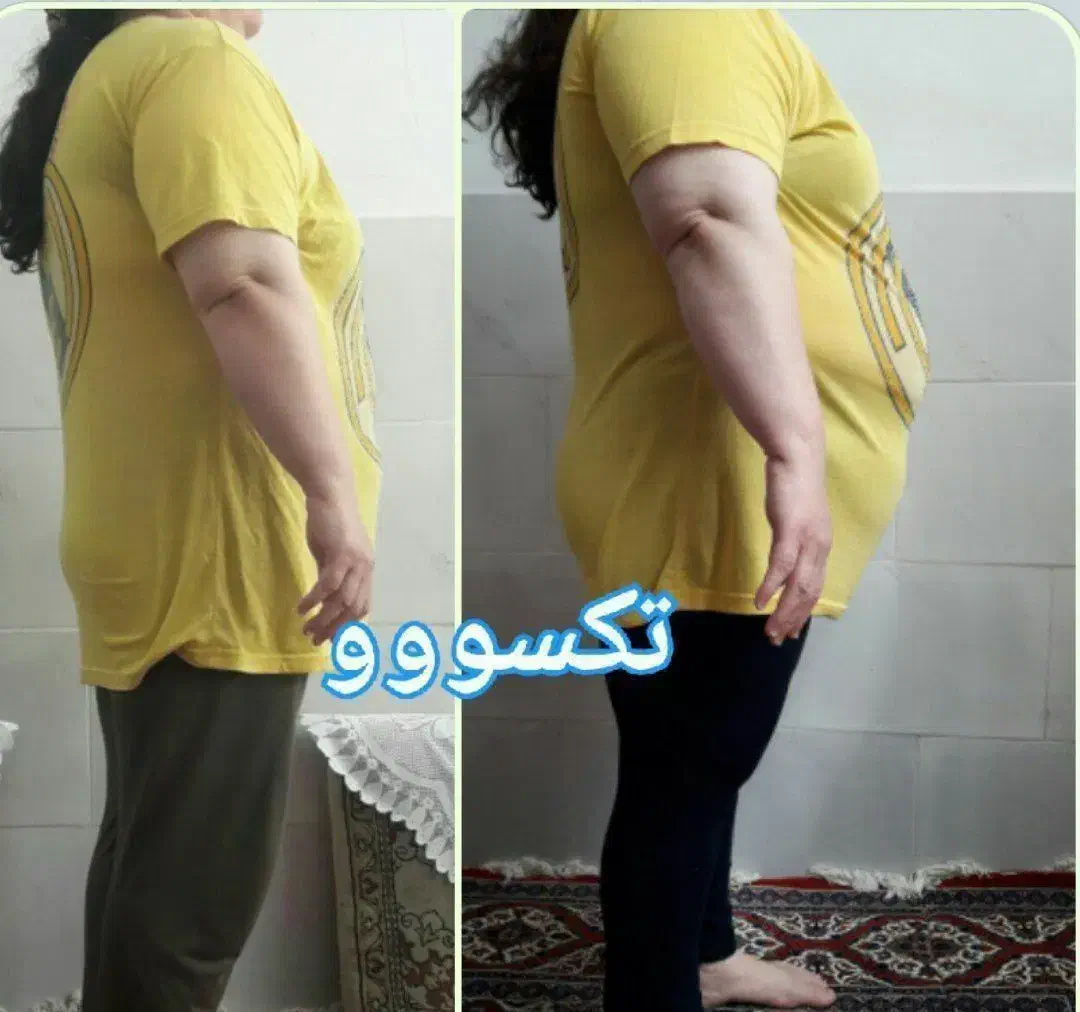 لاغری تضمینی با اصلاح مزاج|آرایشی، بهداشتی، درمانی|اهواز, شهرک شهید میثمی|دیوار