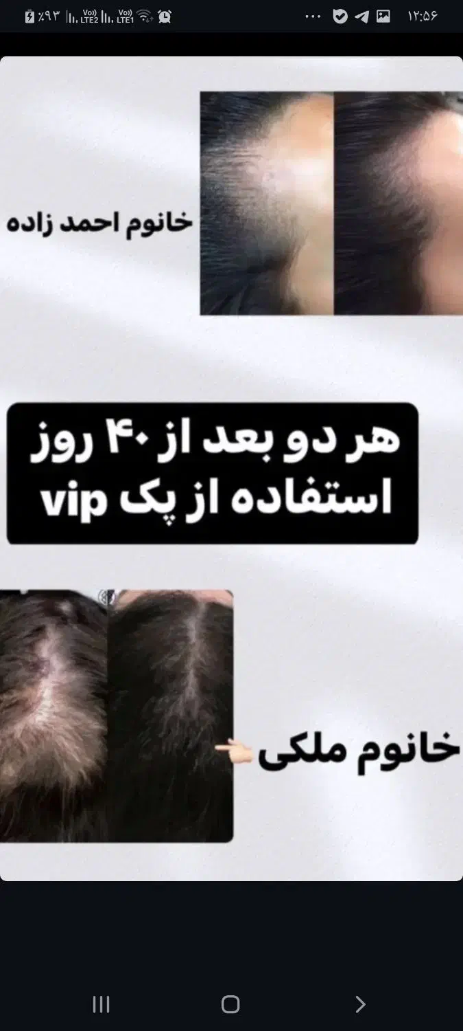 قطع کامل ریزش موباضمانت.تونیک گیاهی هیرفرند|آرایشی، بهداشتی، درمانی|اصفهان, شهرک ولیعصر|دیوار