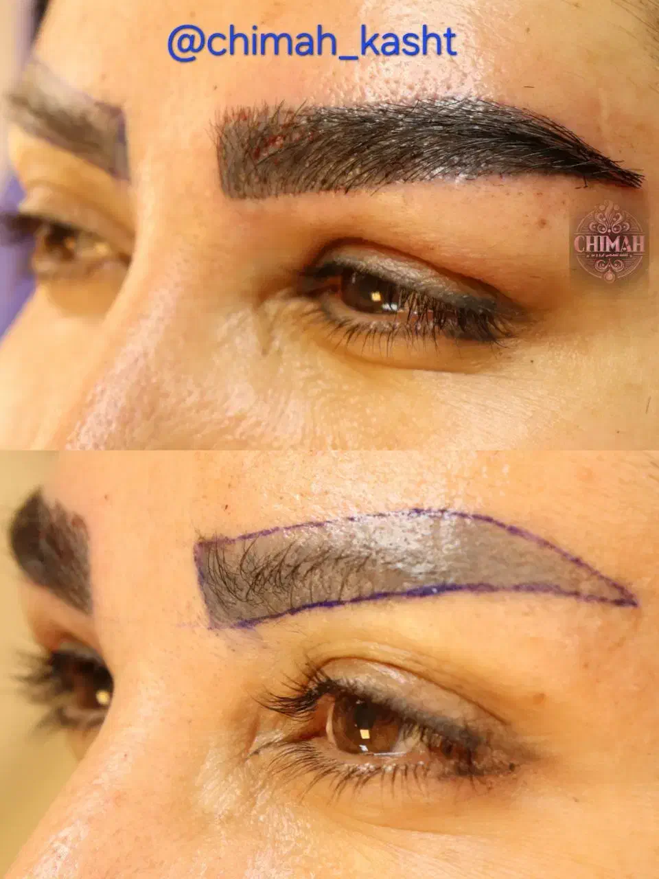 کاشت ابرو و مو با تیم متخصص|خدمات آرایشگری و زیبایی|الشتر, |دیوار