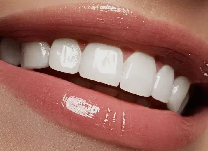 خدمات دندانی|خدمات آرایشگری و زیبایی|زنجان, |دیوار