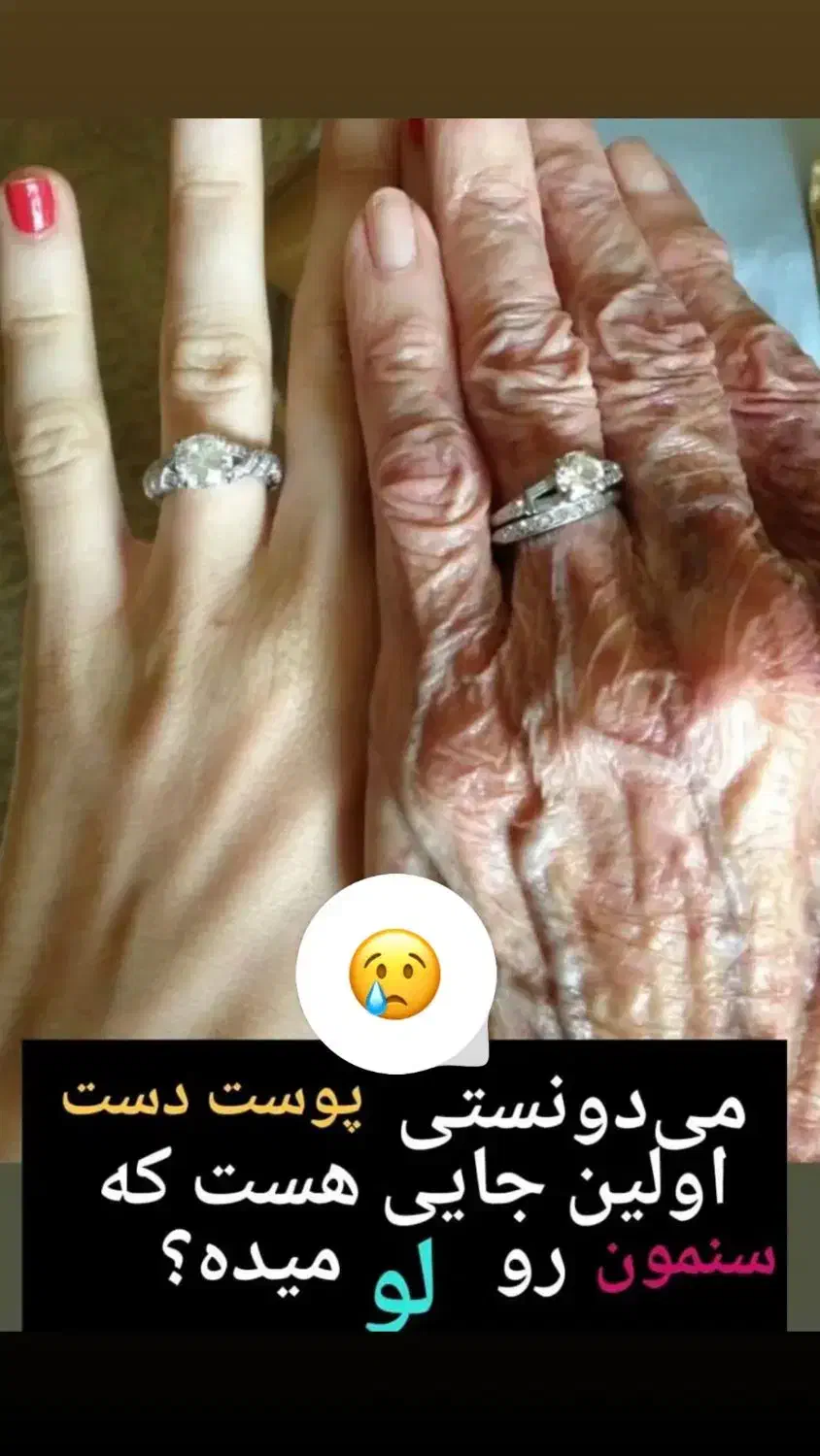 کرم جوانساز پوست دست و صورت|آرایشی، بهداشتی، درمانی|شیراز, بازار|دیوار