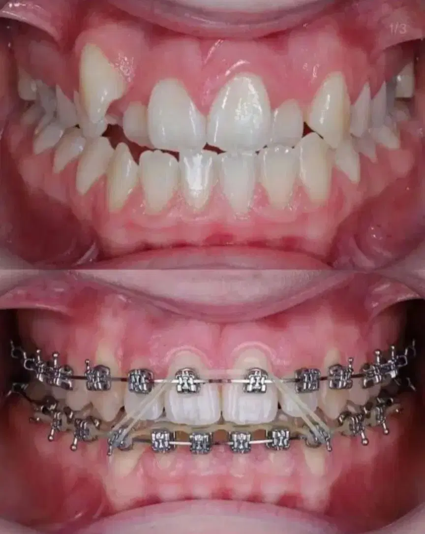 دندانپزشکی مرکز تخصصی ارتودنسی با شرایط فوق العاده|خدمات زیبایی و سلامت|تبریز, |دیوار