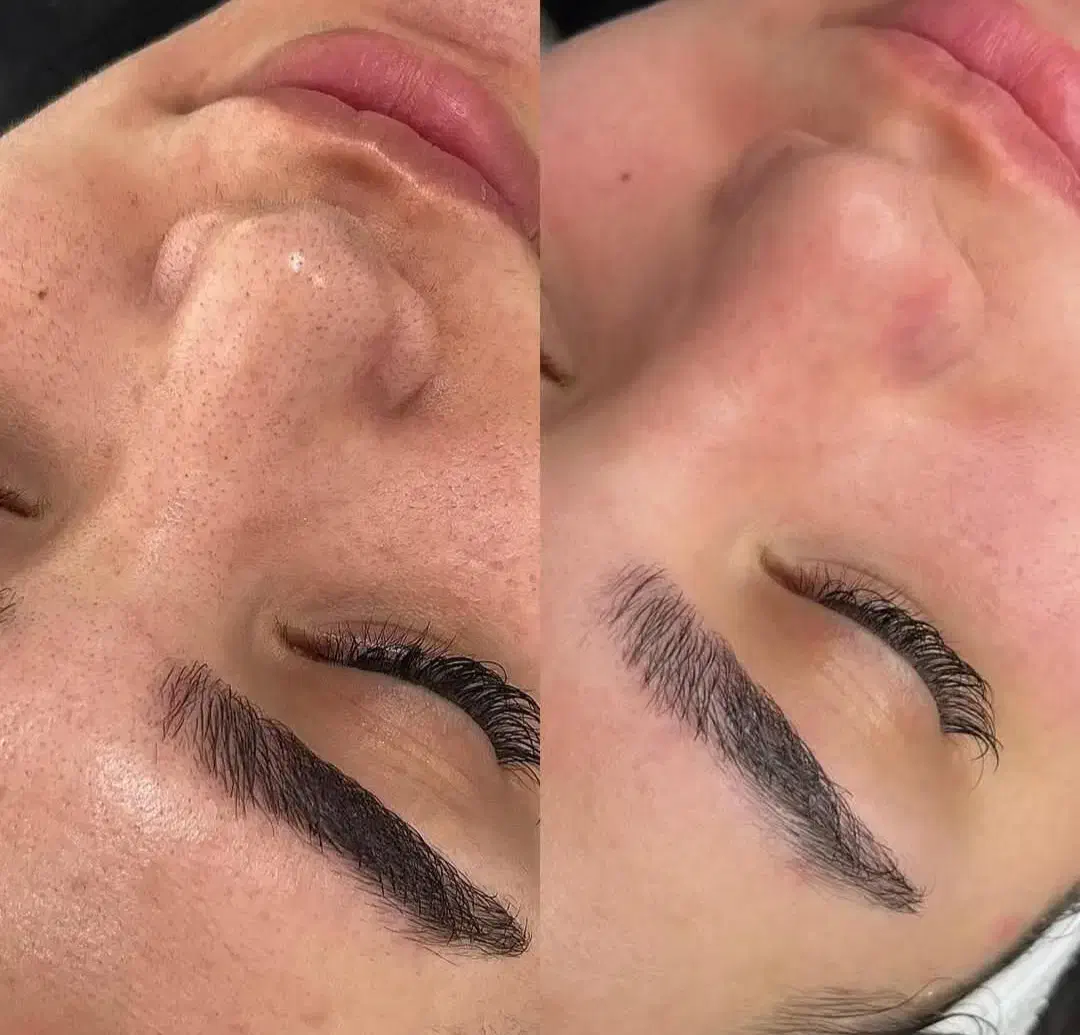 پاکسازی و فیشال پوست|خدمات آرایشگری و زیبایی|میبد, |دیوار