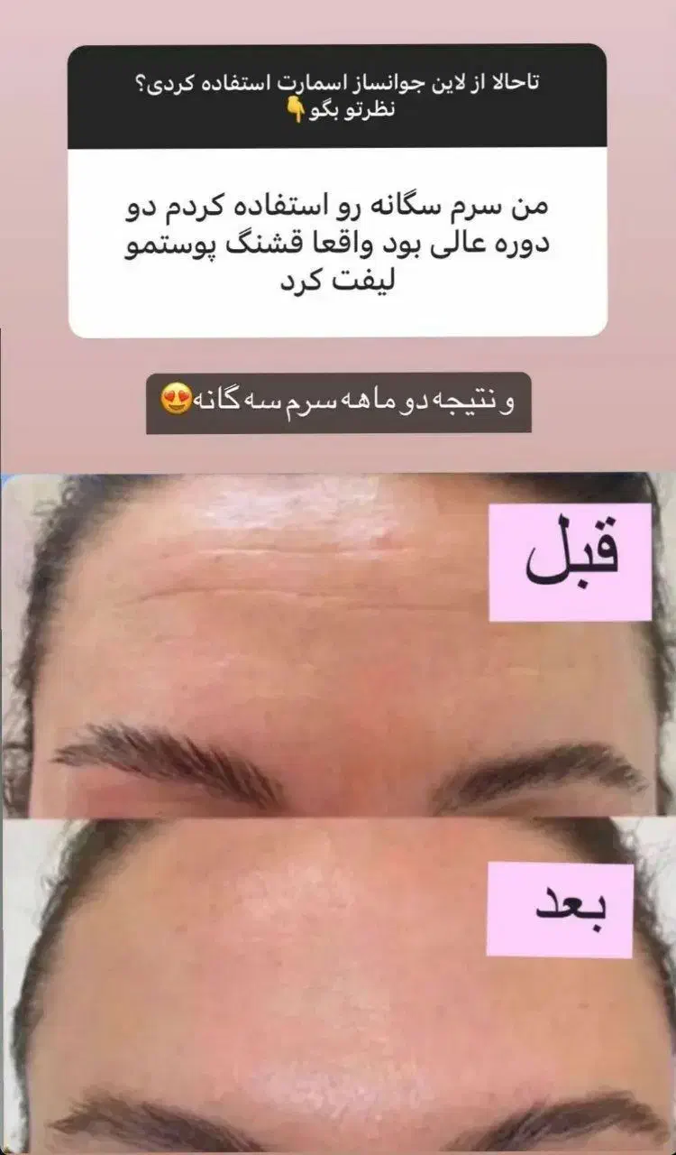 محصولات جوانساز ضد چین وچروک|آرایشی، بهداشتی، درمانی|تهران, الهیه|دیوار