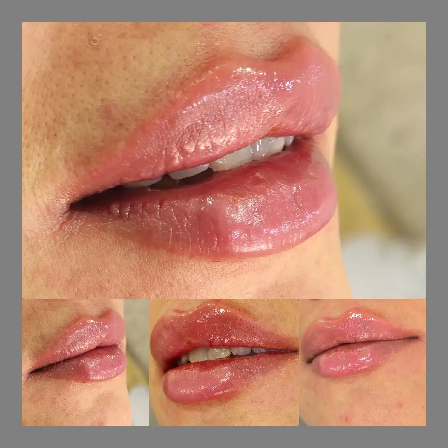 جشنواره تخفیف هفتگی ویژه نخ،مادلینگ فول فیس|خدمات آرایشگری و زیبایی|شاهین‌شهر, فردوسی|دیوار