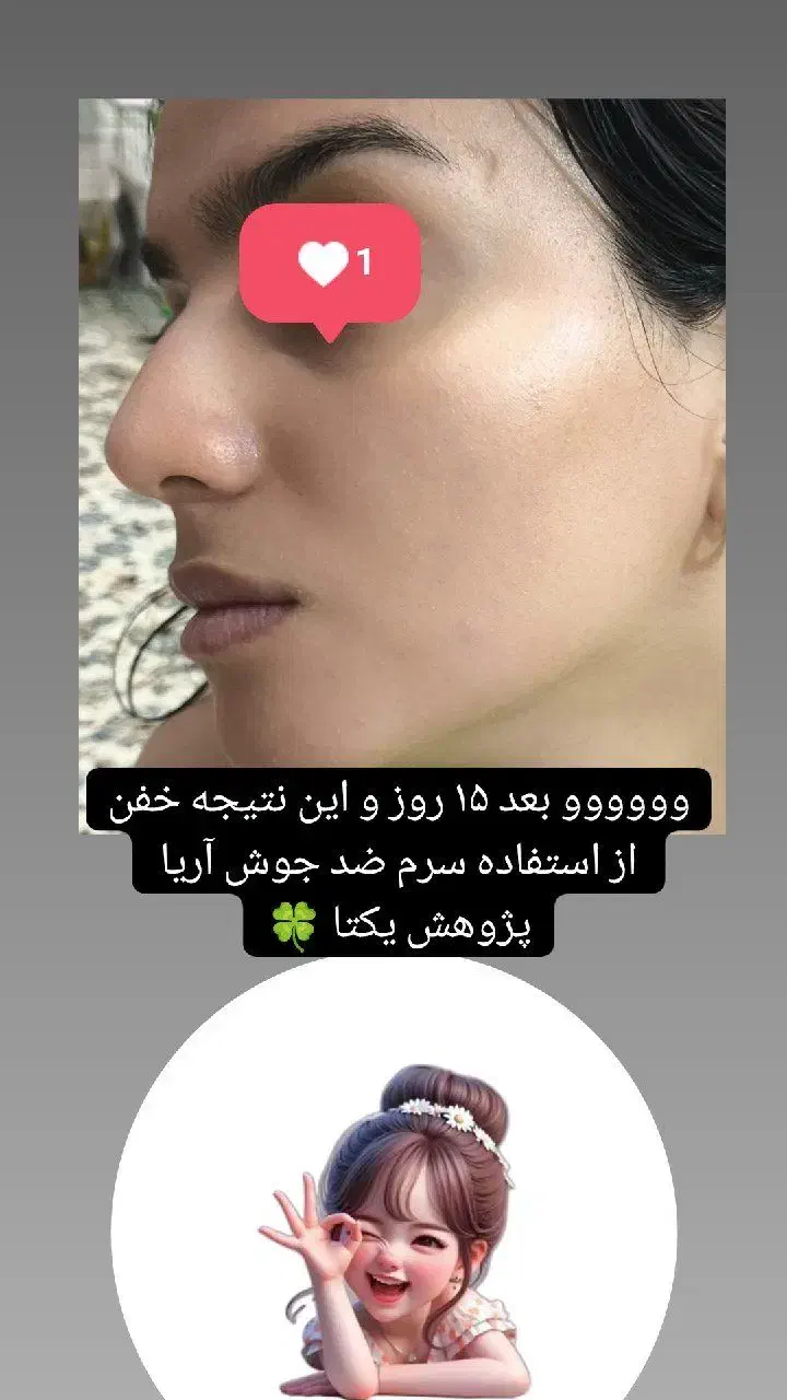 سرم نیاسینامید ضد لک وجوش|آرایشی، بهداشتی، درمانی|شیراز, باغ تخت|دیوار
