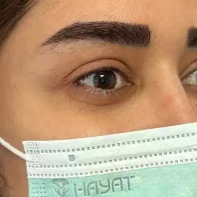 استخدام کات کار کاشت|استخدام درمانی، زیبایی، بهداشتی|شیراز, ارم|دیوار