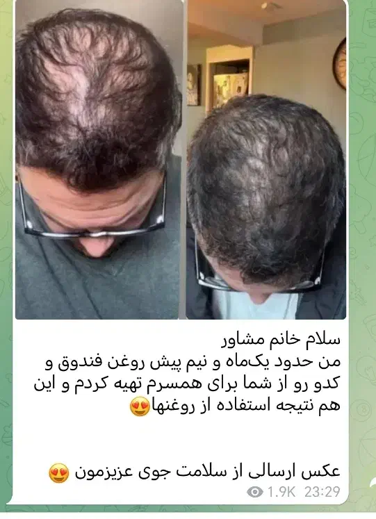 رویش طبیعی|آرایشی، بهداشتی، درمانی|نجف‌آباد, شهدای غربی|دیوار