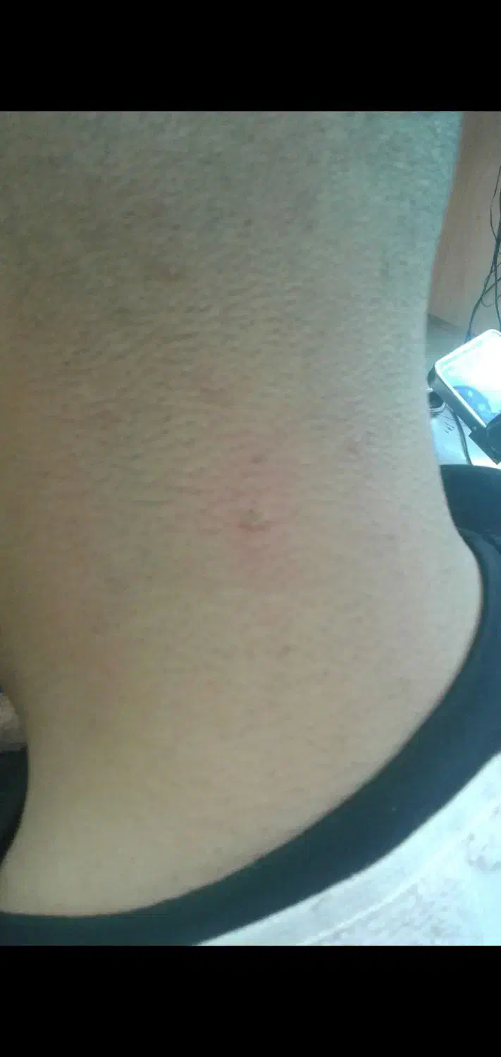 خال برداری|خدمات آرایشگری و زیبایی|ورامین, ورامین|دیوار