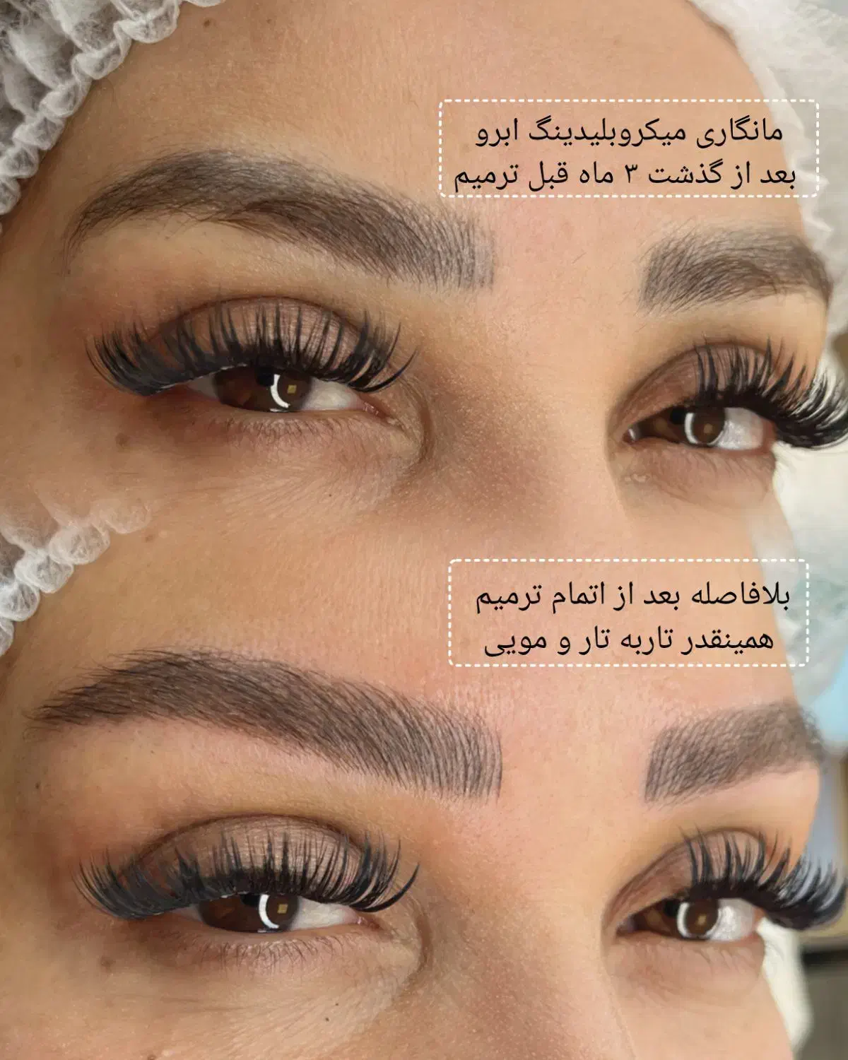 میکروبلیدینگ سوپرنچرال با شرایط ویژه|خدمات آرایشگری و زیبایی|رشت, گلسار|دیوار