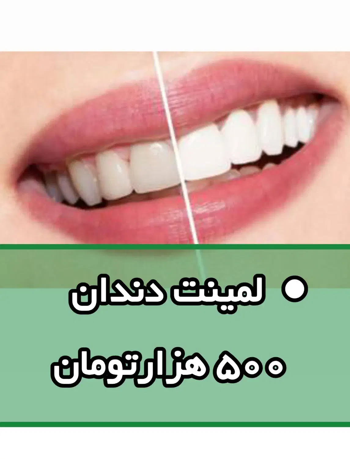 LQ660 بهاران|تخت و صندلی بچه|خرمآباد, |دیوار