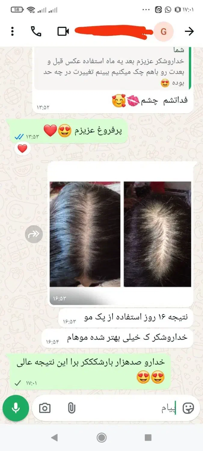 تونیک تقویت ورشد مو|آرایشی، بهداشتی، درمانی|شهر بابک, |دیوار