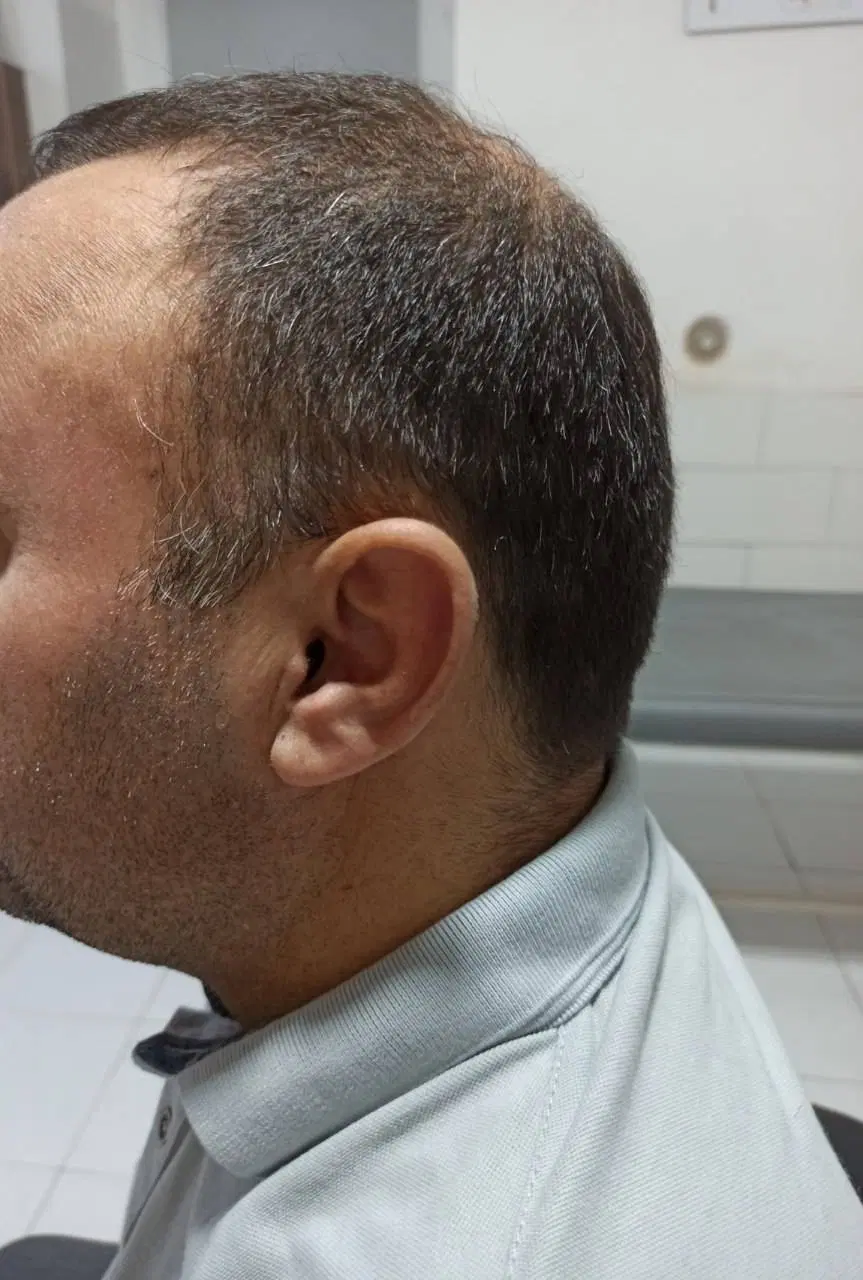 کلینیک تخصصی شنوایی و سمعک نرخ دولتی(اقساطی)|آرایشی، بهداشتی، درمانی|تهران, افسریه جنوبی|دیوار