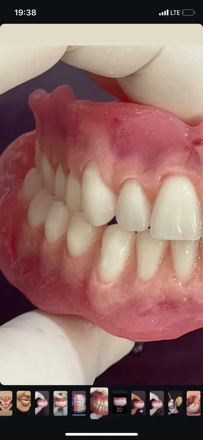 ساخت پروتز متحرک|آرایشی، بهداشتی، درمانی|آمل, |دیوار