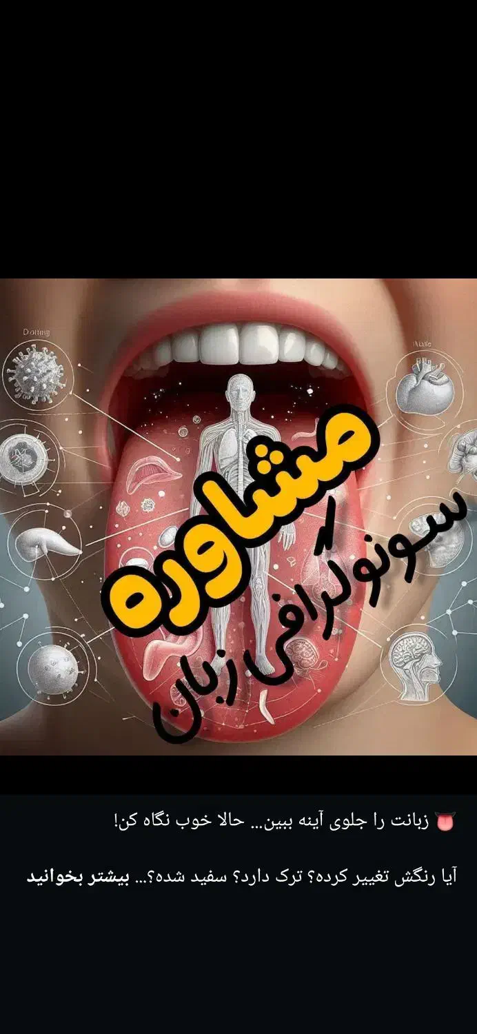 محصولات نیوشا|فعالیت داوطلبانه|چالوس, |دیوار
