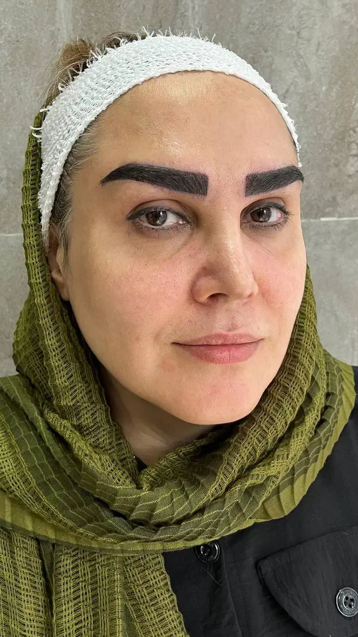 کاشت ابروی مادام العمر در کلینیک تخصصی پوست و مو|خدمات آرایشگری و زیبایی|فولادشهر, C5|دیوار