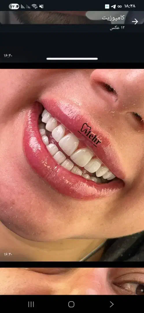 کامپوزیت هشت واحد فقط با ۵ تومان|خدمات آرایشگری و زیبایی|تهران, هفت حوض|دیوار