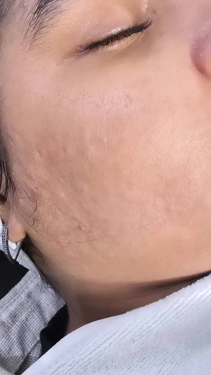 آموزش و فیشیال تخصصی از صفر تا ورود به بازار کار|خدمات آموزشی|آبادان, |دیوار