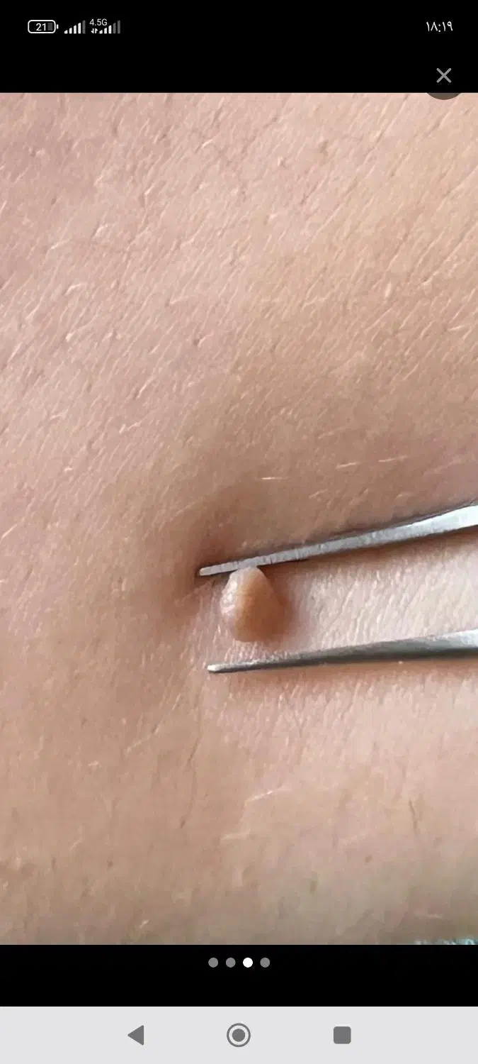 خال برداری|خدمات آرایشگری و زیبایی|قم, امامزاده ابراهیم|دیوار