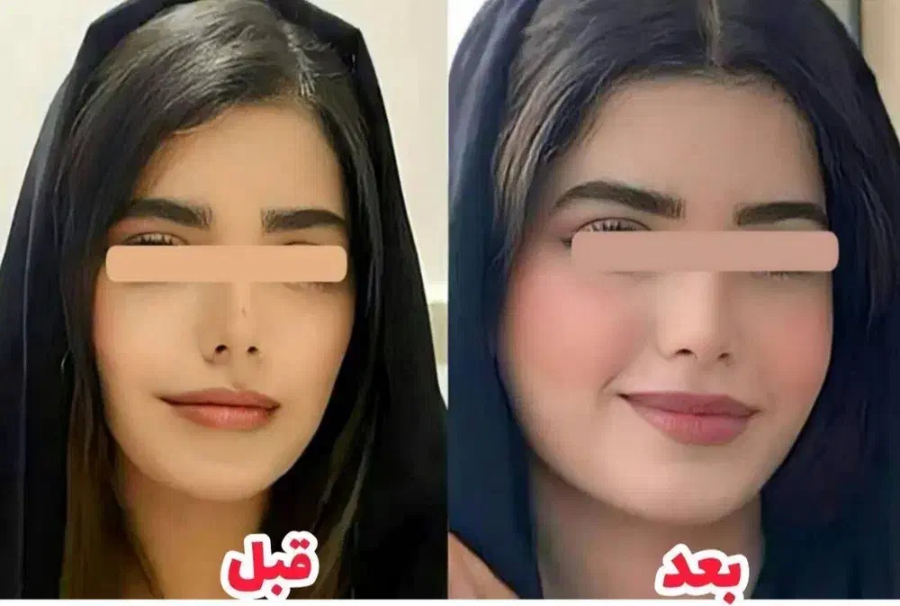 پودر جوانه گندم برای چاقی و تپلی صورت|آرایشی، بهداشتی، درمانی|لاهیجان, امیرشهید|دیوار