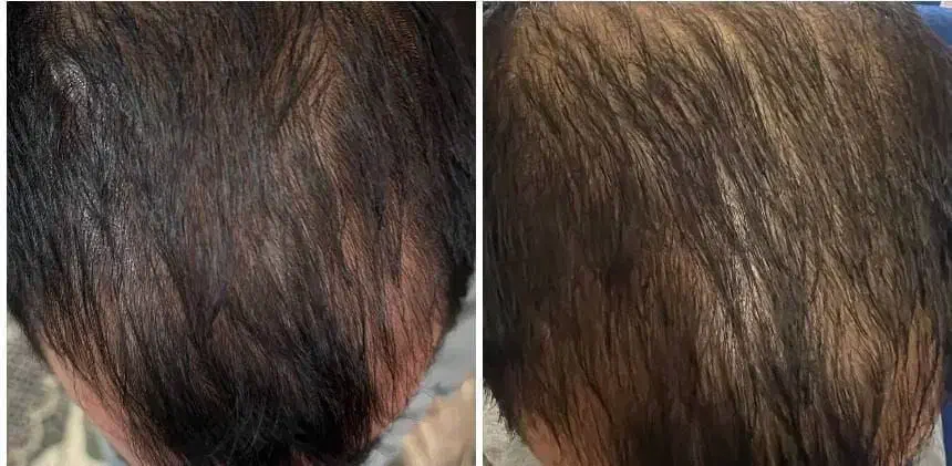 پرپشت شدن مو و رویش موی جدید|آرایشی، بهداشتی، درمانی|گناباد, |دیوار