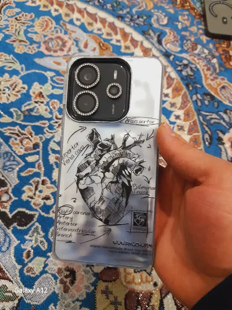 گوشی ردمی نوت ۱۴|موبایل|آبیک, |دیوار