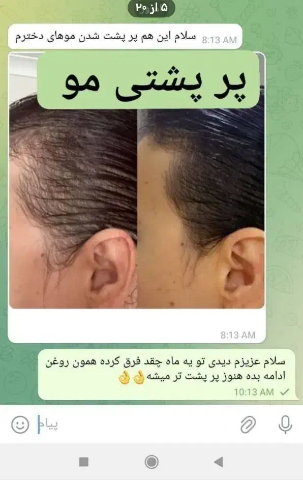 رویش طبیعی|آرایشی، بهداشتی، درمانی|نجف‌آباد, شهدای غربی|دیوار