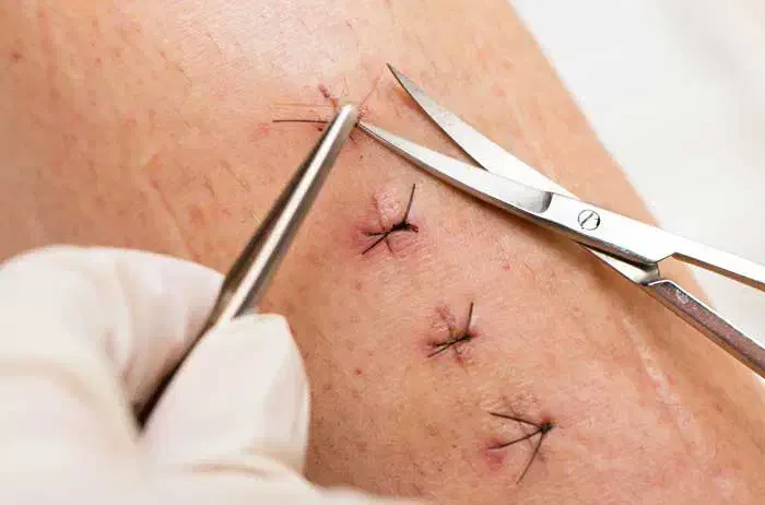 انجام خدمات پرستاری در منزل|خدمات آرایشگری و زیبایی|سقز, |دیوار