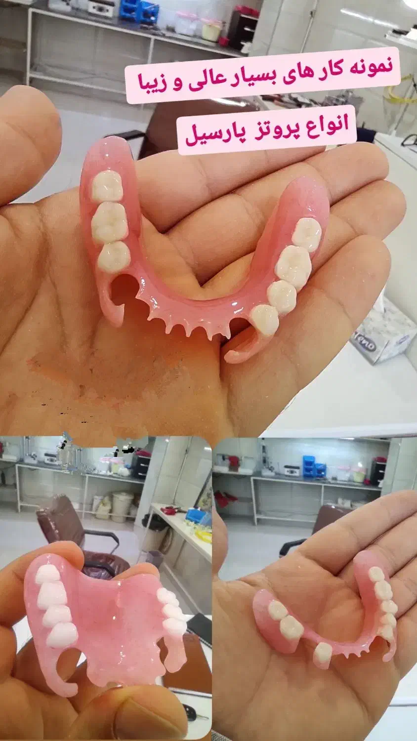 دندان مصنوعی  ( تمام چک )|آرایشی، بهداشتی، درمانی|پارس‌آباد, |دیوار