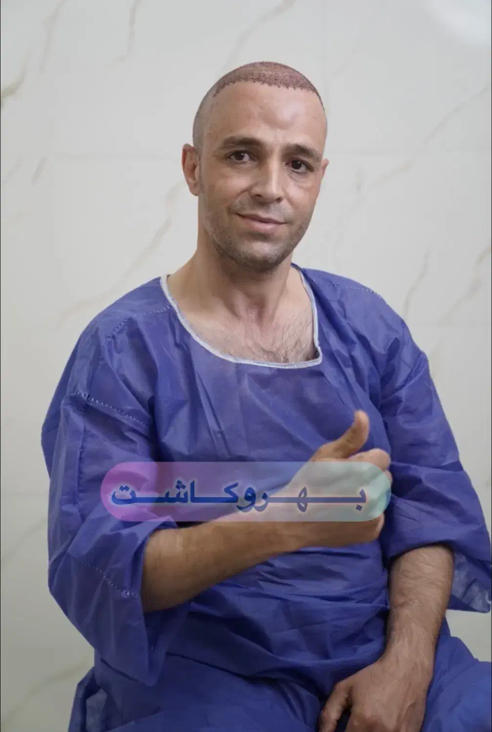 آموزش کاشت مو|خدمات آموزشی|قم, صفائیه|دیوار