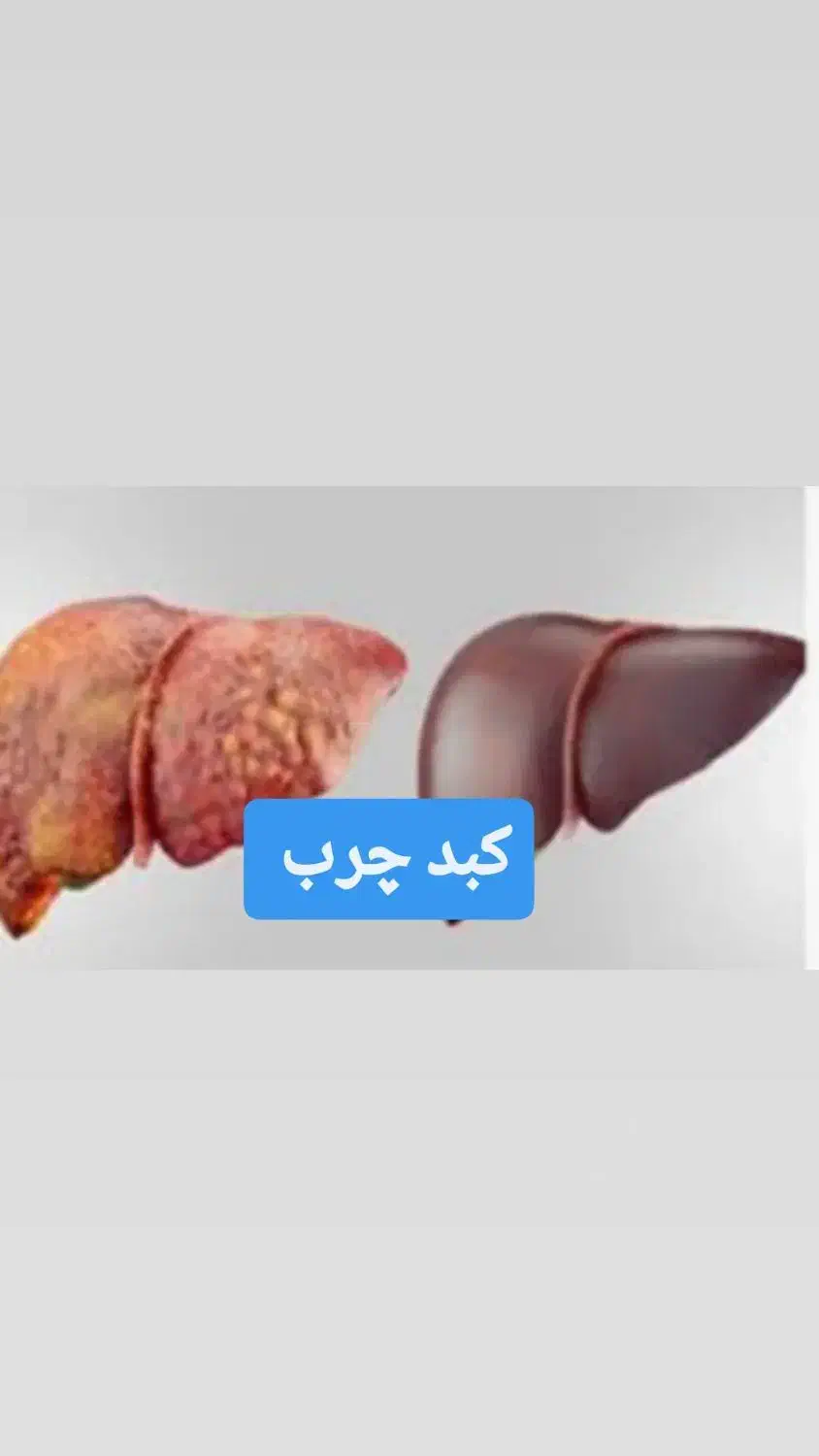 به کبدت زندگی بده|آرایشی، بهداشتی، درمانی|اهواز, شهرک نفت|دیوار