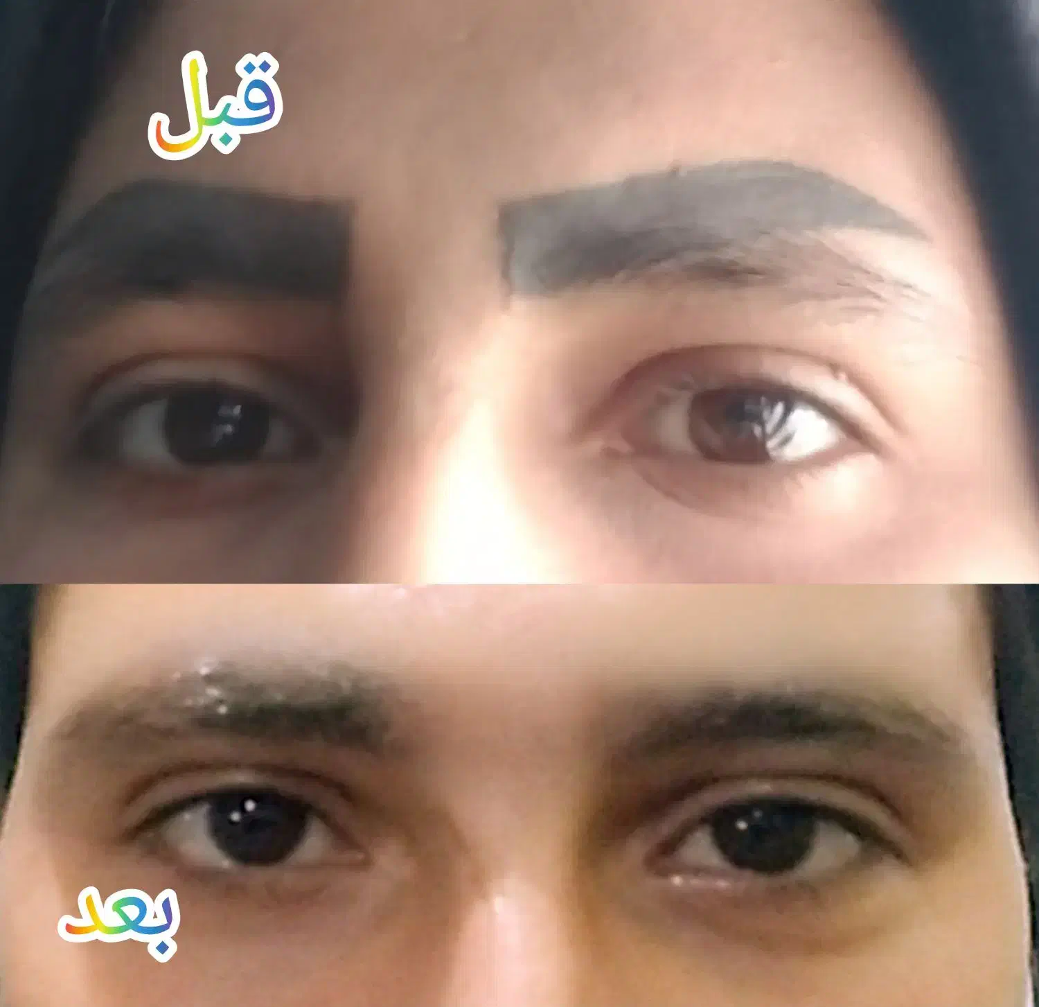 اموزش و خدمات ریموو تک جلسه ای با ض.م.ا.ن.ت|خدمات آرایشگری و زیبایی|کرمان, |دیوار