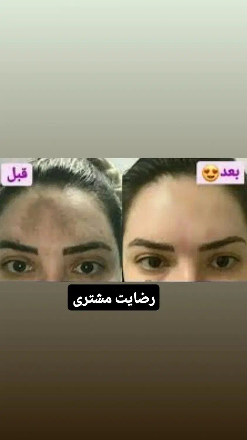 کرم آیدن معجزه خاورمیانه|آرایشی، بهداشتی، درمانی|ایرانشهر, |دیوار