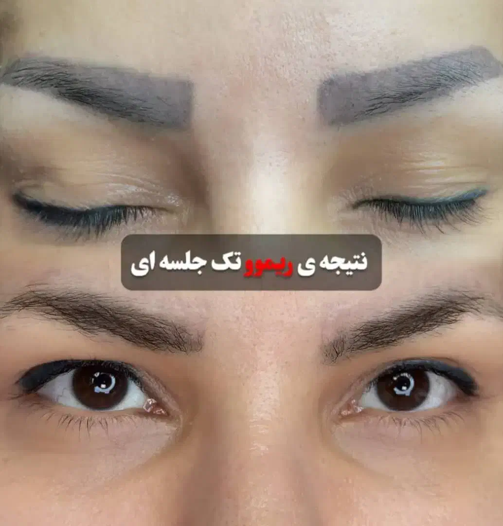 تخصصی پوست و مو و لیزر|خدمات آرایشگری و زیبایی|یاسوج, |دیوار