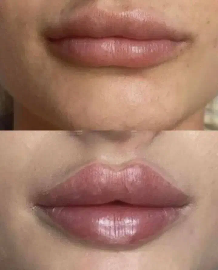 ژل لب گونه چونه زاویه خدمات پرسینگ|خدمات آرایشگری و زیبایی|صدرا-فارس, فاز ۱|دیوار