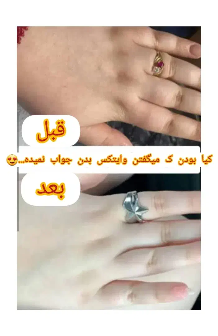 کرم سفید کننده صورت|آرایشی، بهداشتی، درمانی|میناب, |دیوار