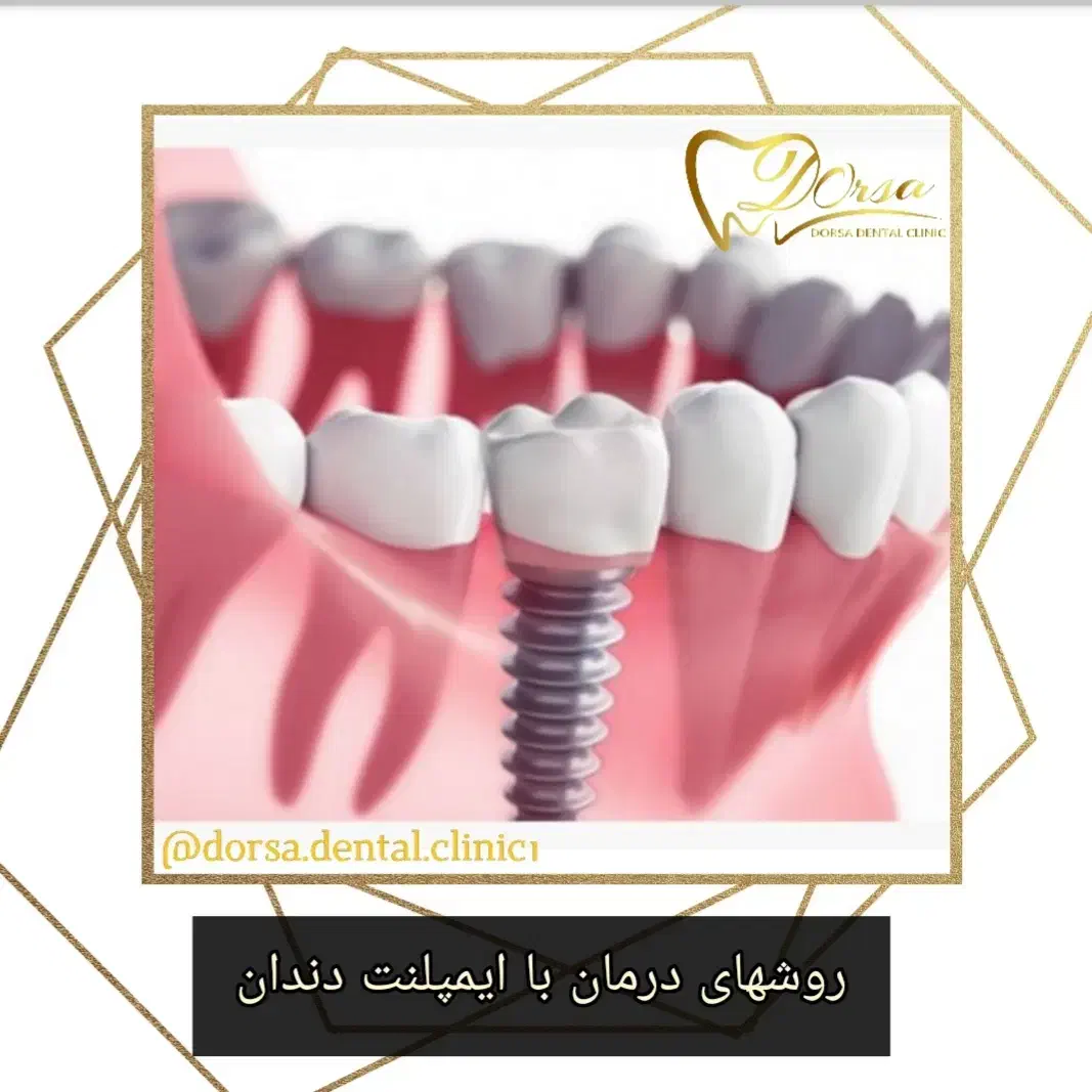 خدمات اقساطی دندانپزشکی|خدمات آرایشگری و زیبایی|شاهینشهر, خبرنگار|دیوار