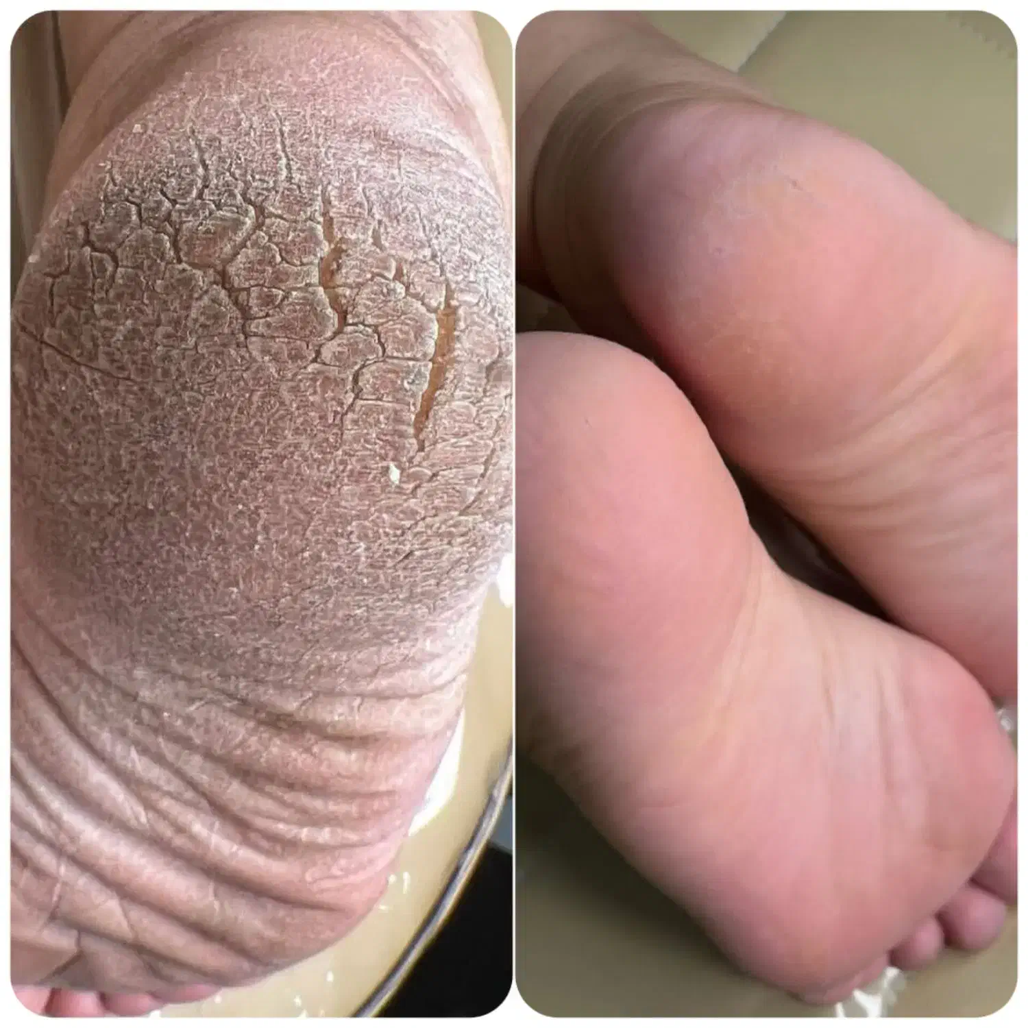 اسپا ناخن اپیلاسیون پارافین تتو بدن|خدمات آرایشگری و زیبایی|سلطانیه, |دیوار