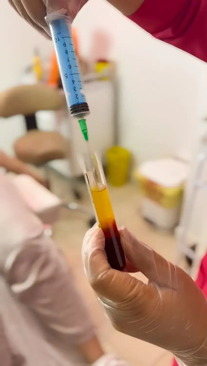 جشنواره تخفیف پی آر پی(PRP)/مزونیدلینگ مو و صورت|خدمات آرایشگری و زیبایی|اصفهان, باغ زرشک|دیوار