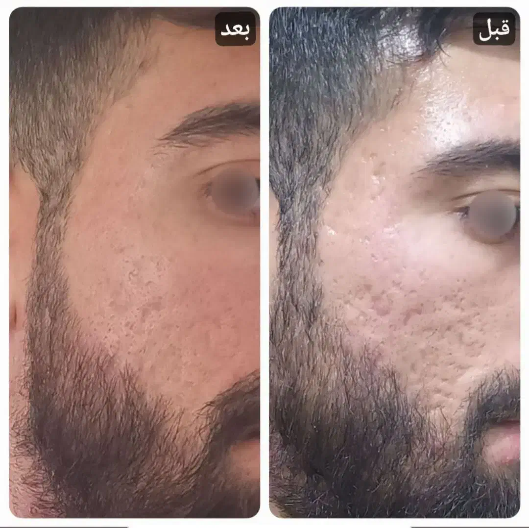 پکیج ترمیم پوست|آرایشی، بهداشتی، درمانی|سقز, |دیوار