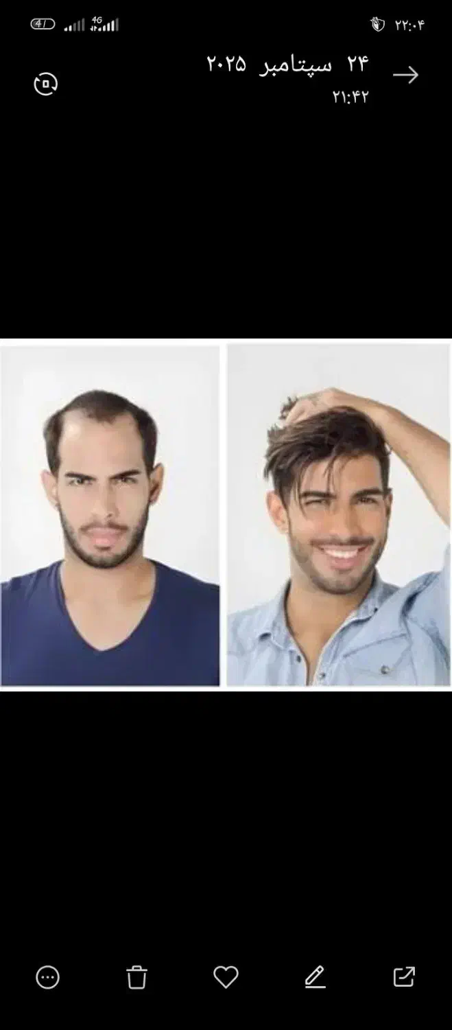 خدا حافظی با بی مویی|خدمات آرایشگری و زیبایی|فردیس, فردیس|دیوار