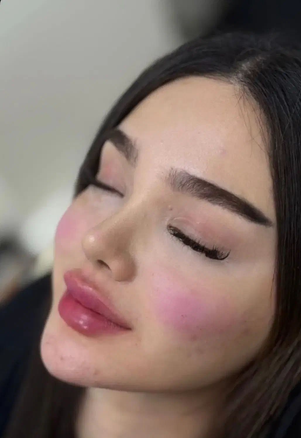 آموزش و تزریق ژل بوتاکس پی ار پی پی ار اف اگزوزوم|خدمات آرایشگری و زیبایی|اهواز, کیانپارس |دیوار